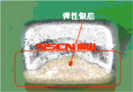 使用柔性端頭降低陶瓷貼片電容短路風(fēng)險(xiǎn)